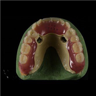 Dentadura Peek Framework
