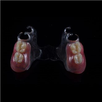 Prótesis parcial de acrílico removible