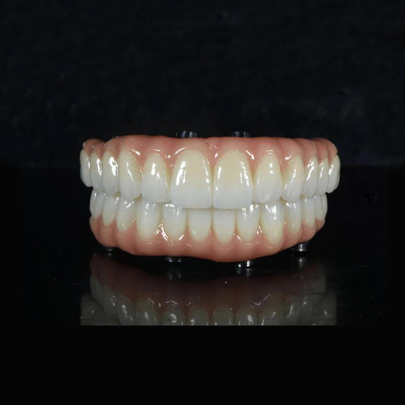 PUENTE ALL-ON -X ZIRCONIA